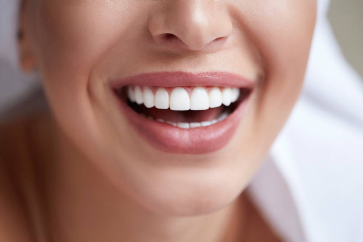 featured image for 10 tips to prevent dental veneers from breaking