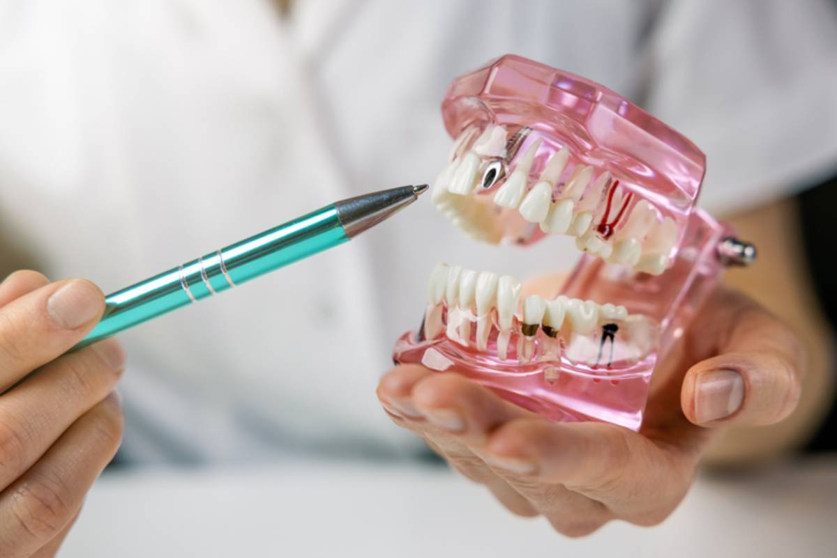 dentist implantologist showing dental implant technology